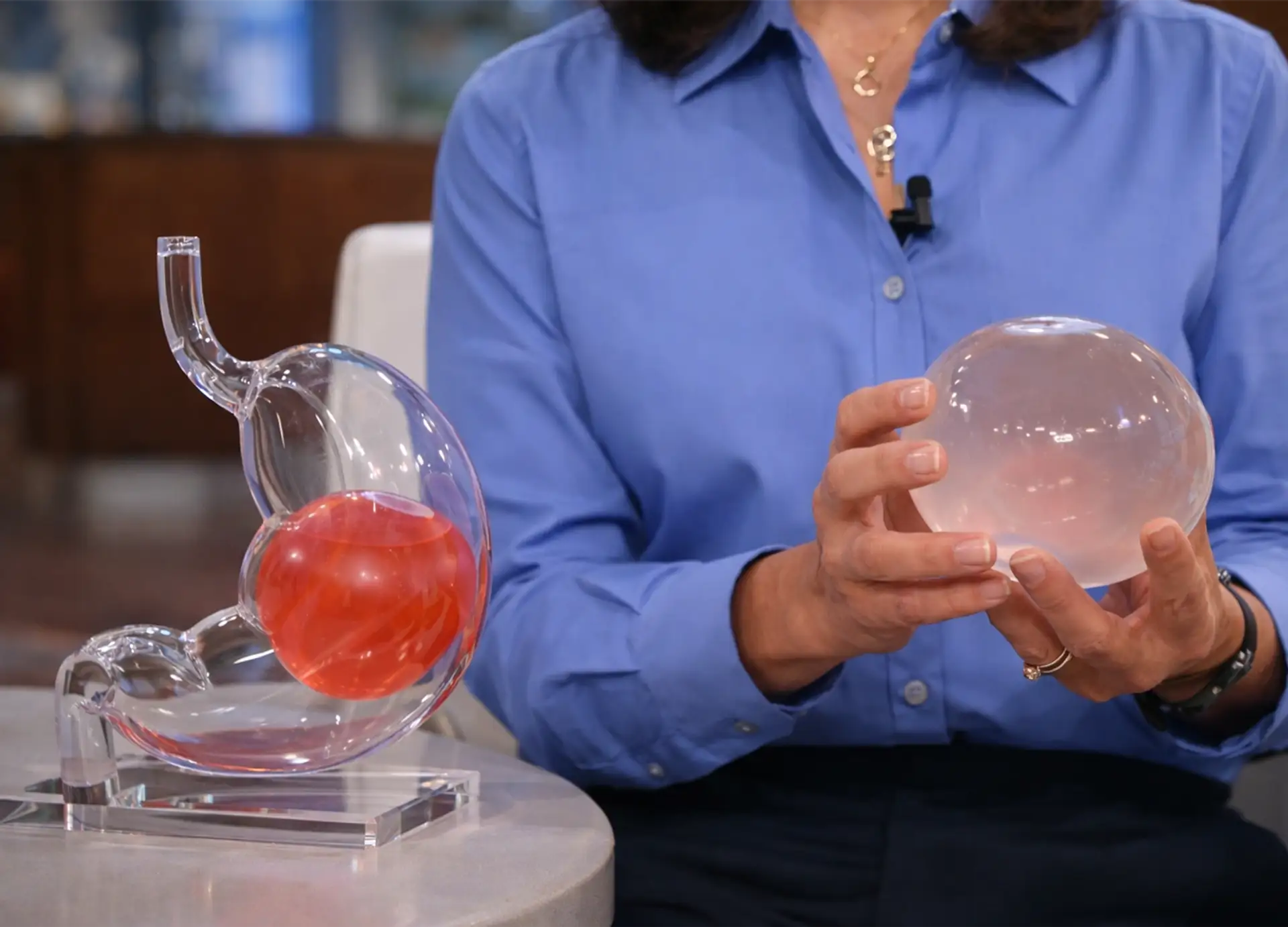 Ventajas y desventajas del balón gástrico