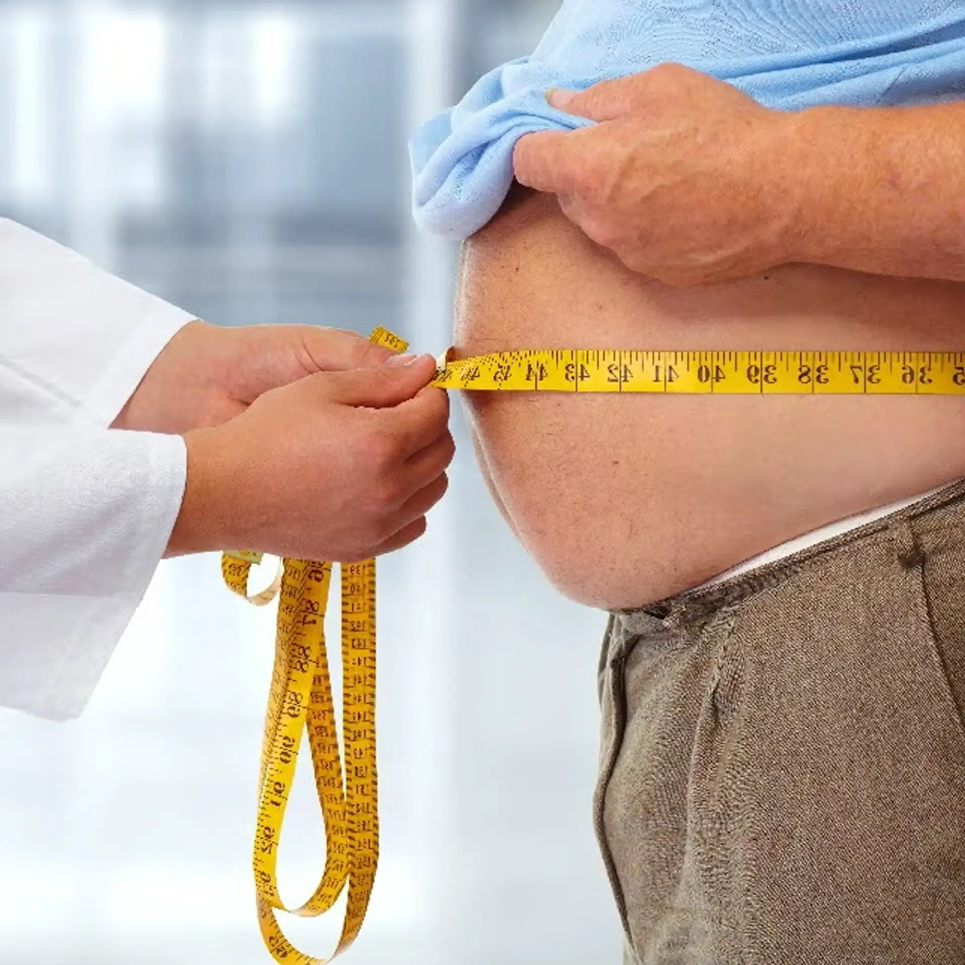 Which Patients Are Recommended to Have Sleeve Gastrosectomy
