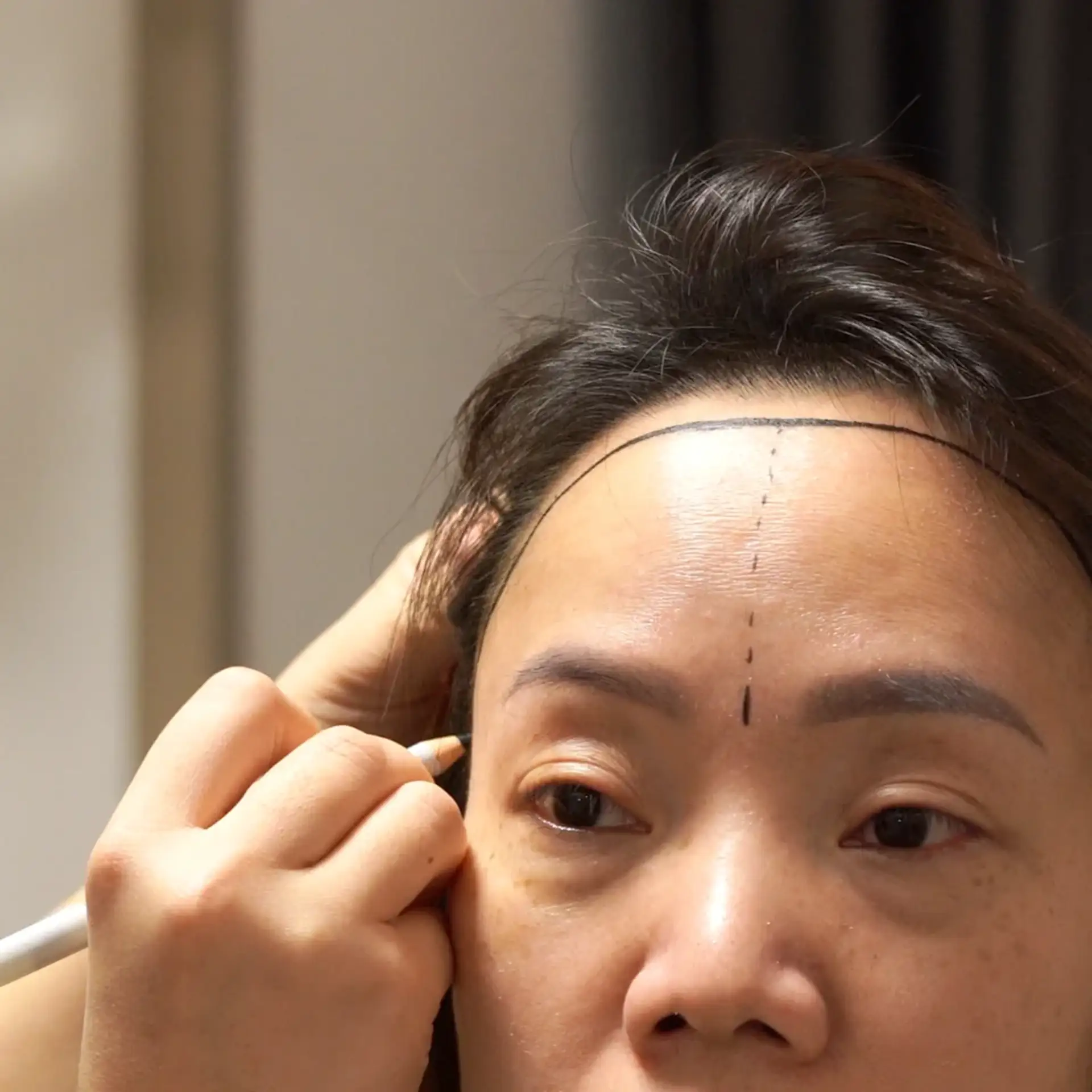 why-turkey-leads-for-women-hair-transplants