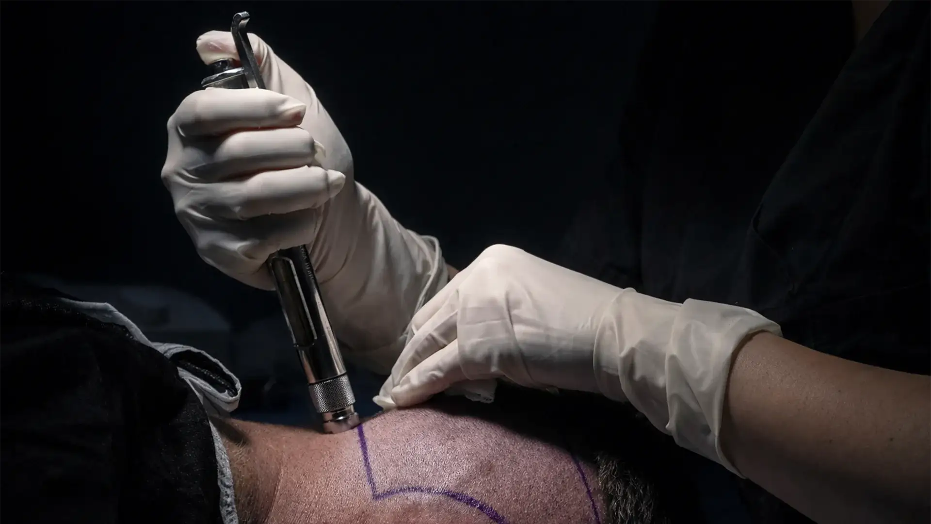 pain-management -anesthesia-protocols