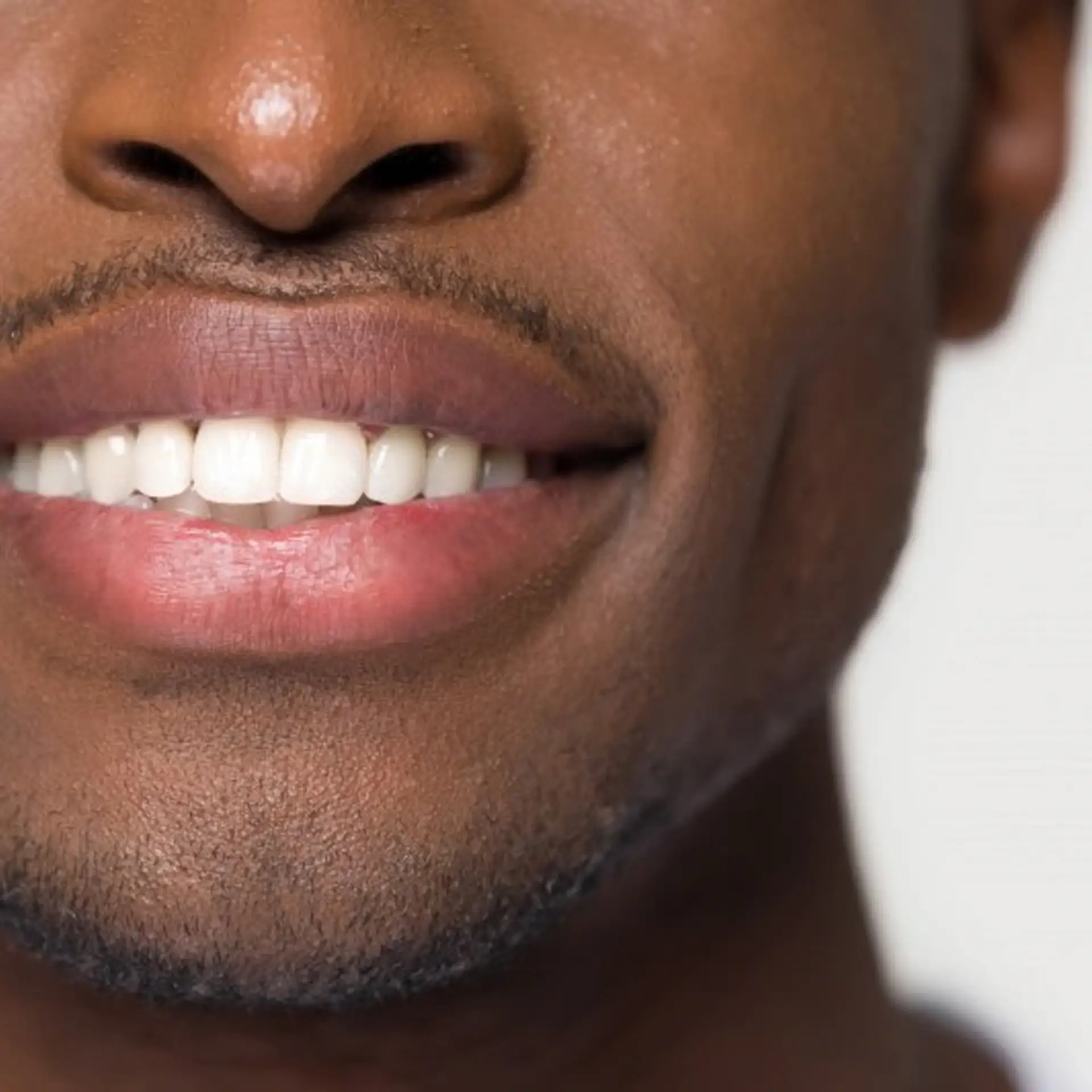 Good Candidates For Dental Veneers
