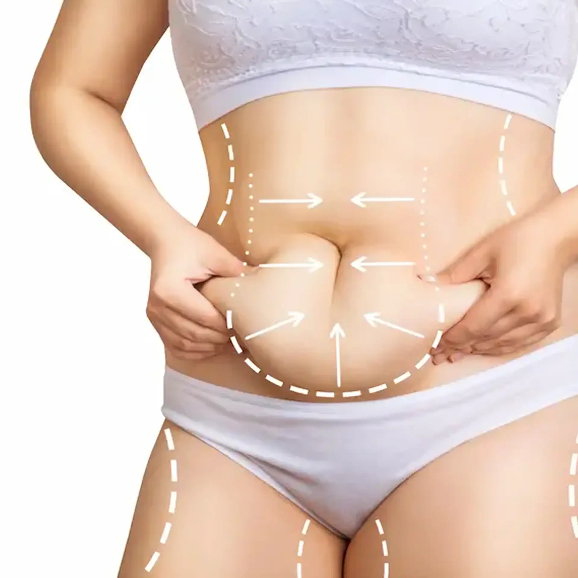 what-is-tummy-tuck-turkey