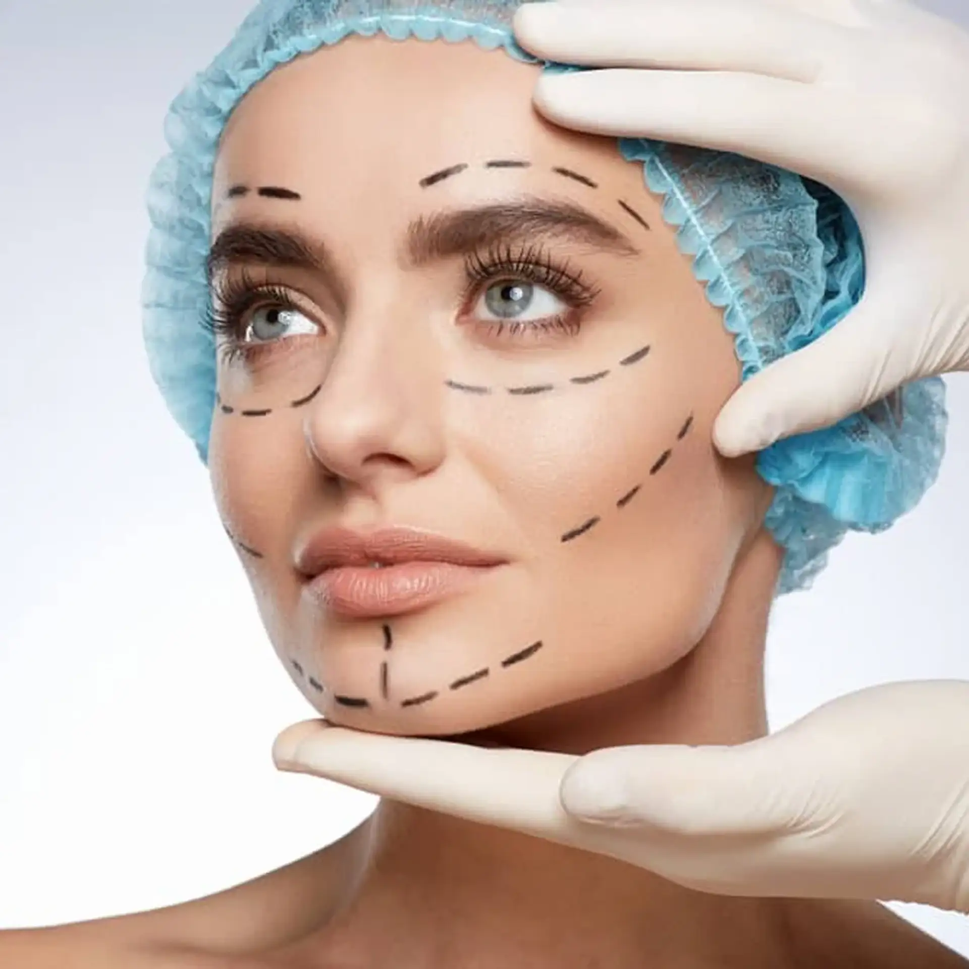 Tipos de cirurgia de lifting facial