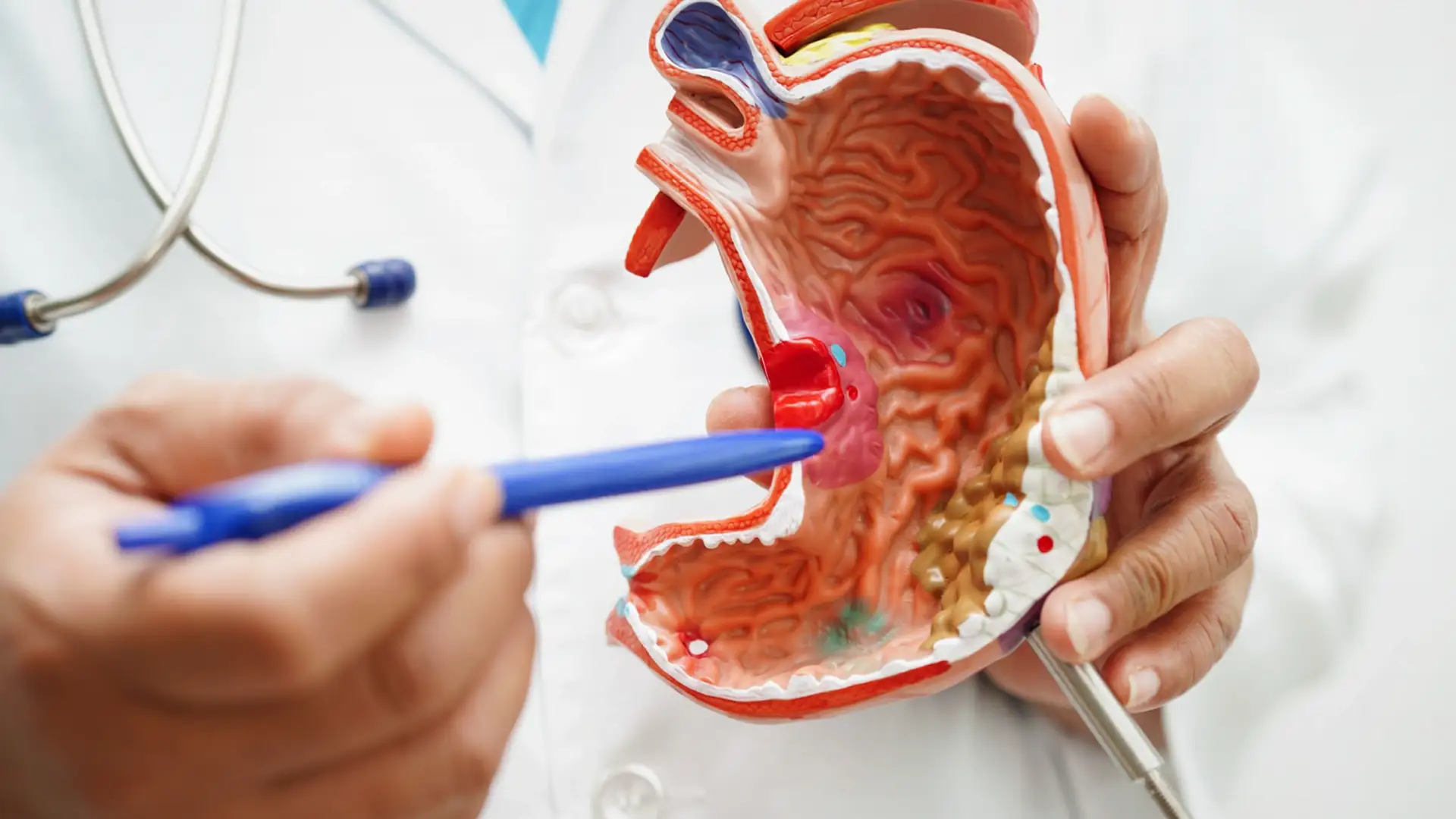 Benefits of Fat Grafting