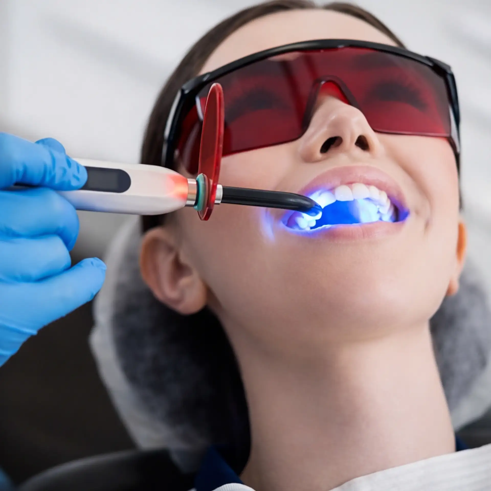 How Long Does Teeth Whitening Lasts