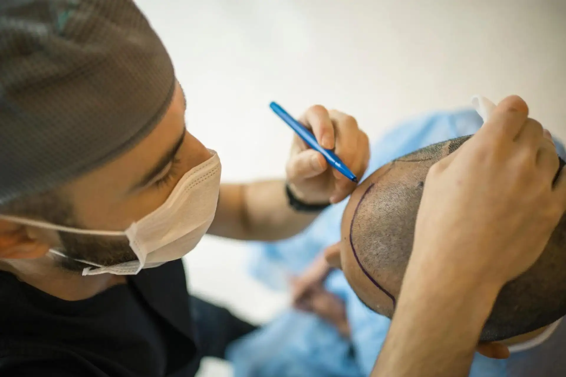 When to Expect Hair Transplant Results: A Guide by Estemoon