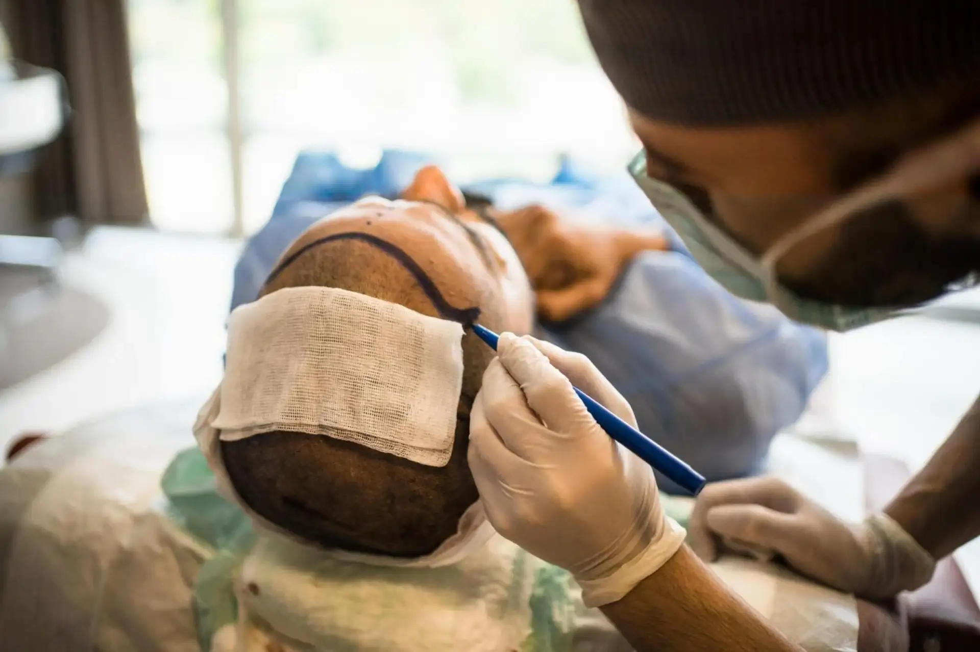 5000 Grafts Haartransplantation Kosten in der Türkei - Estemoon