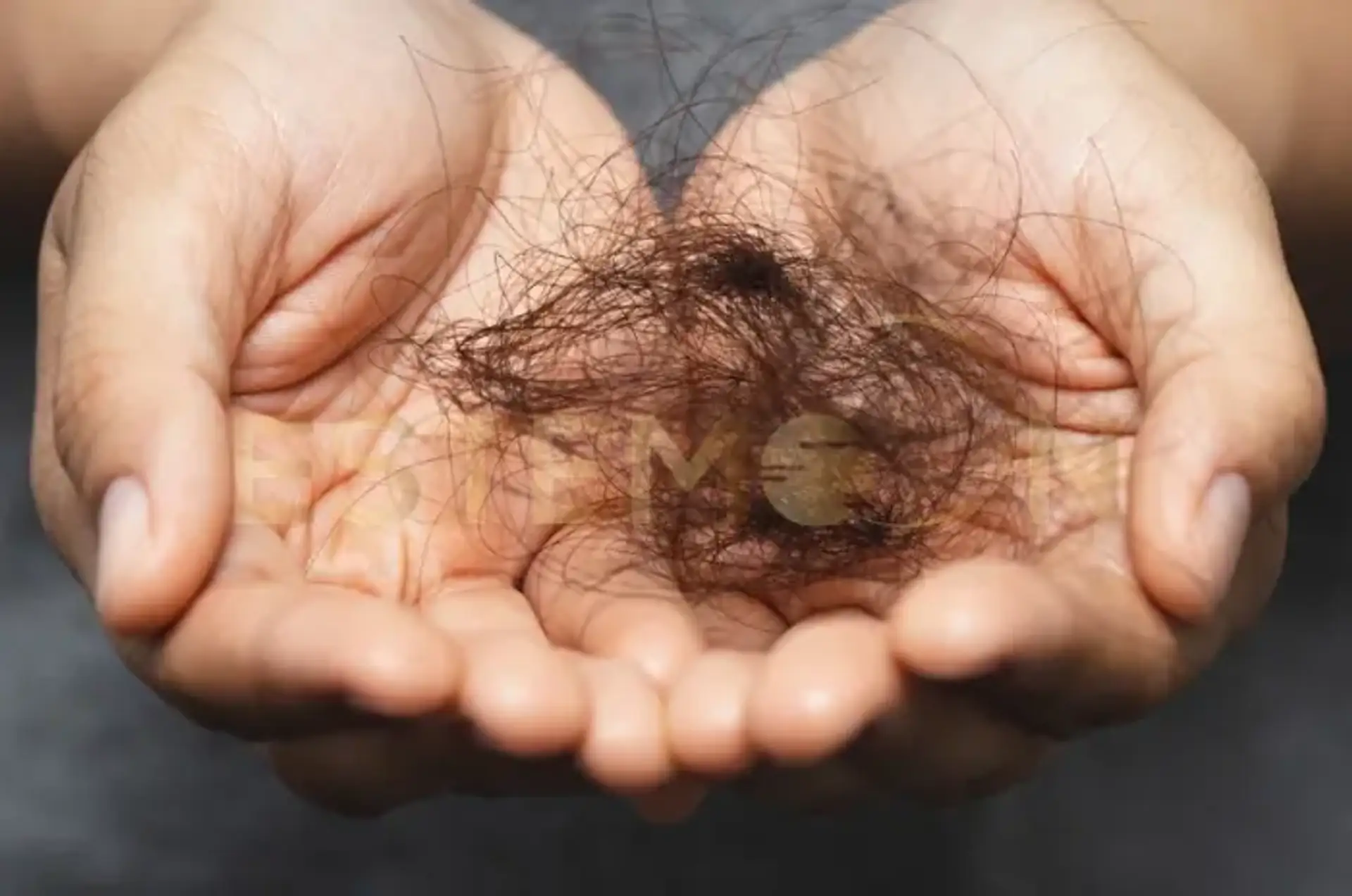 Diffuse Thinning Treatments and Prevention Tips Explained