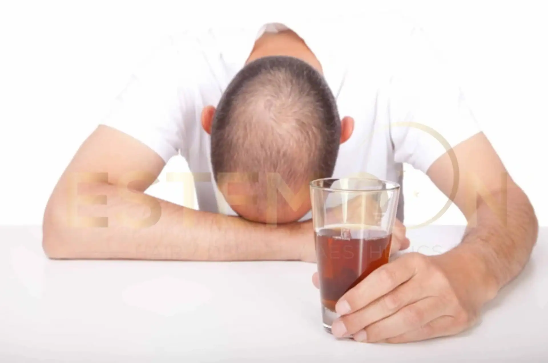 Do Smoking and Alcohol Cause Hair Loss?