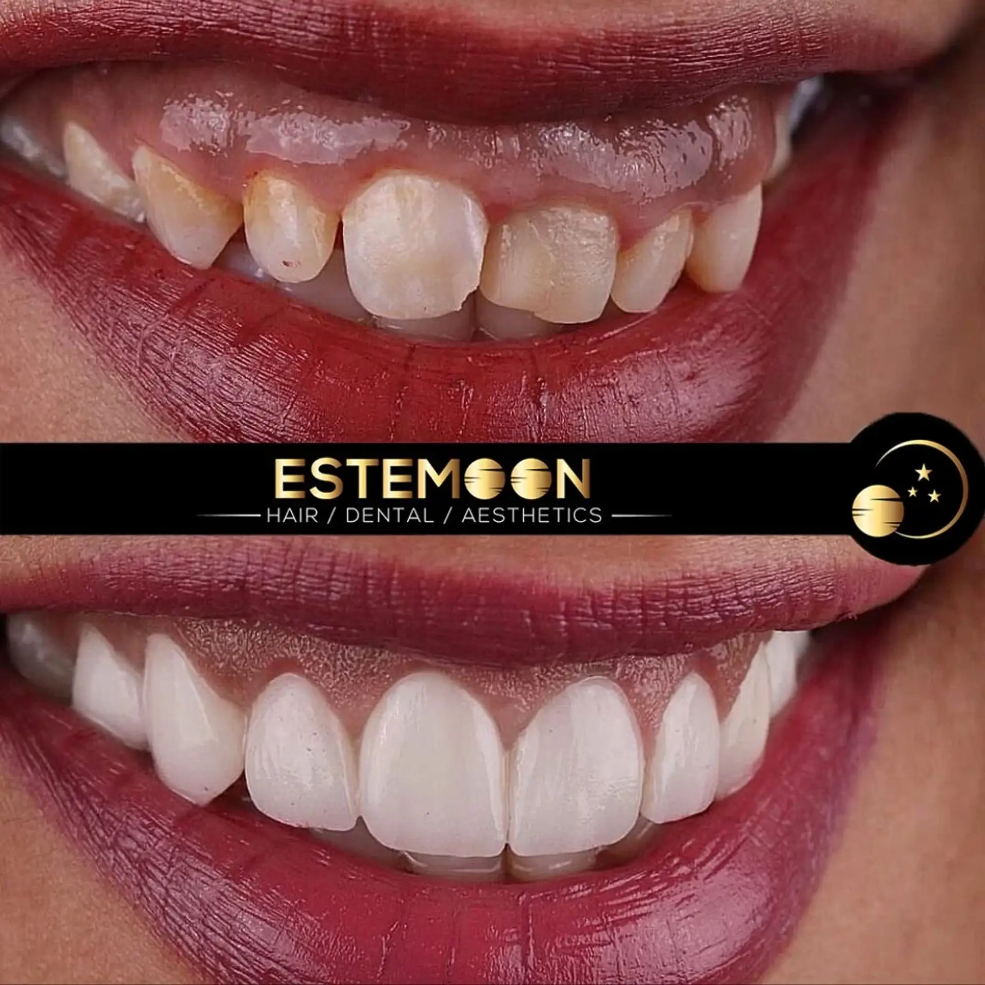 Cosmetic Dentistry in Albania - The Right Choice