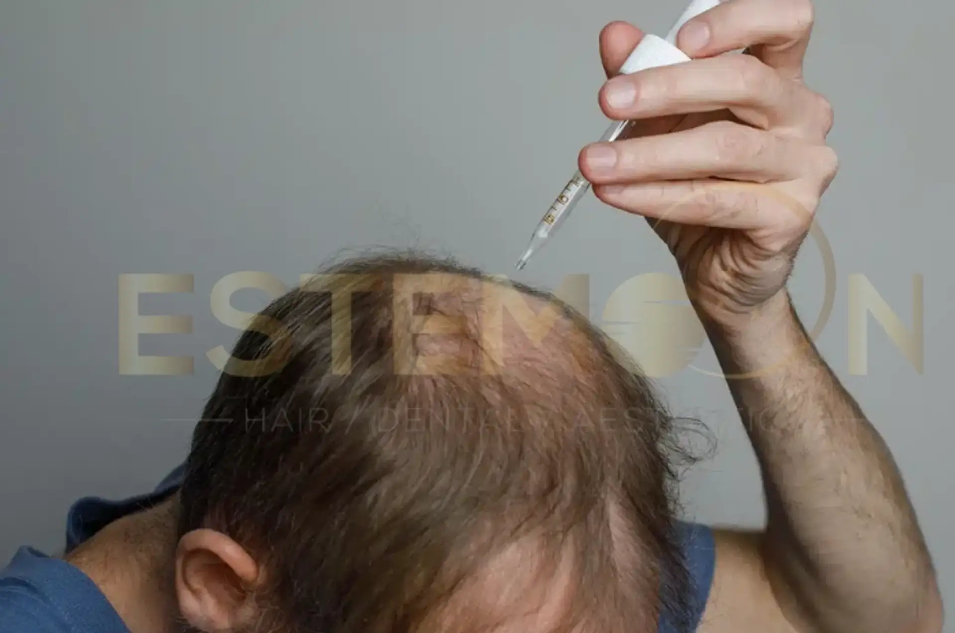 Hair Regrowth for Men How It Truly Works