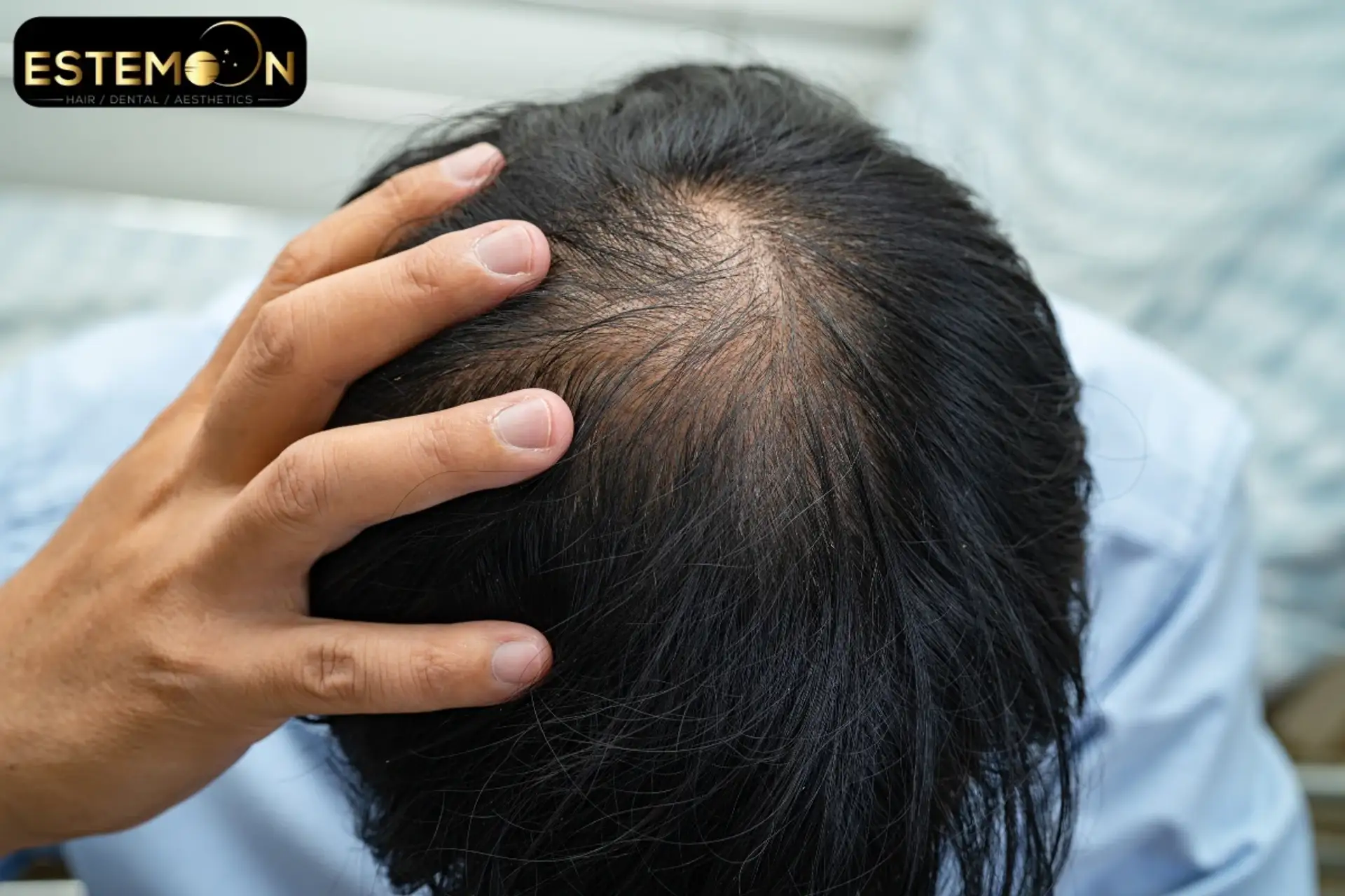 How Much Does a Sapphire FUE Hair Transplant Cost in Turkey?
