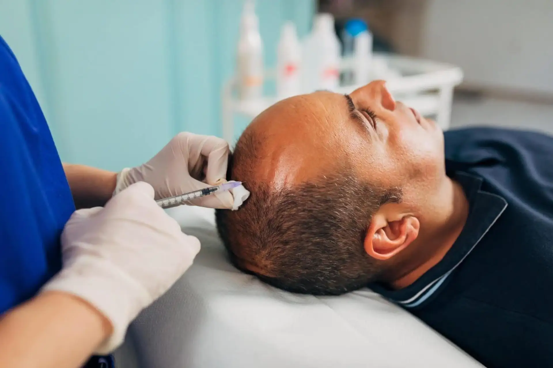Best Hair Transplant Methods in Istanbul: Guide to Estemoon