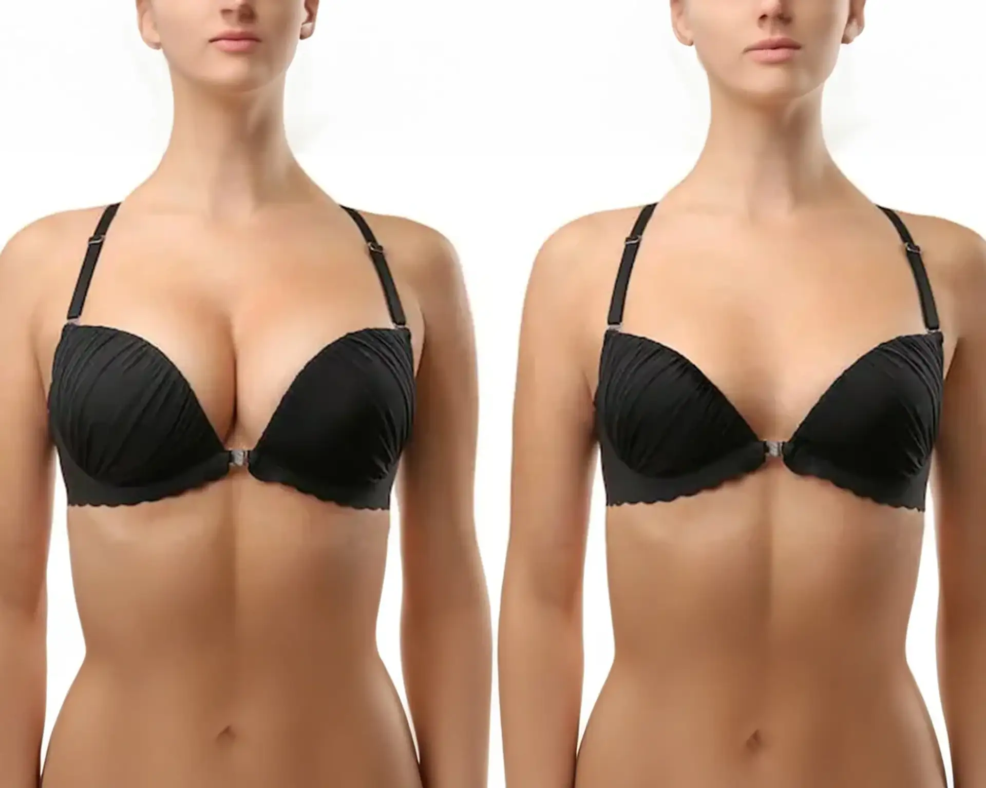 breast-reduction