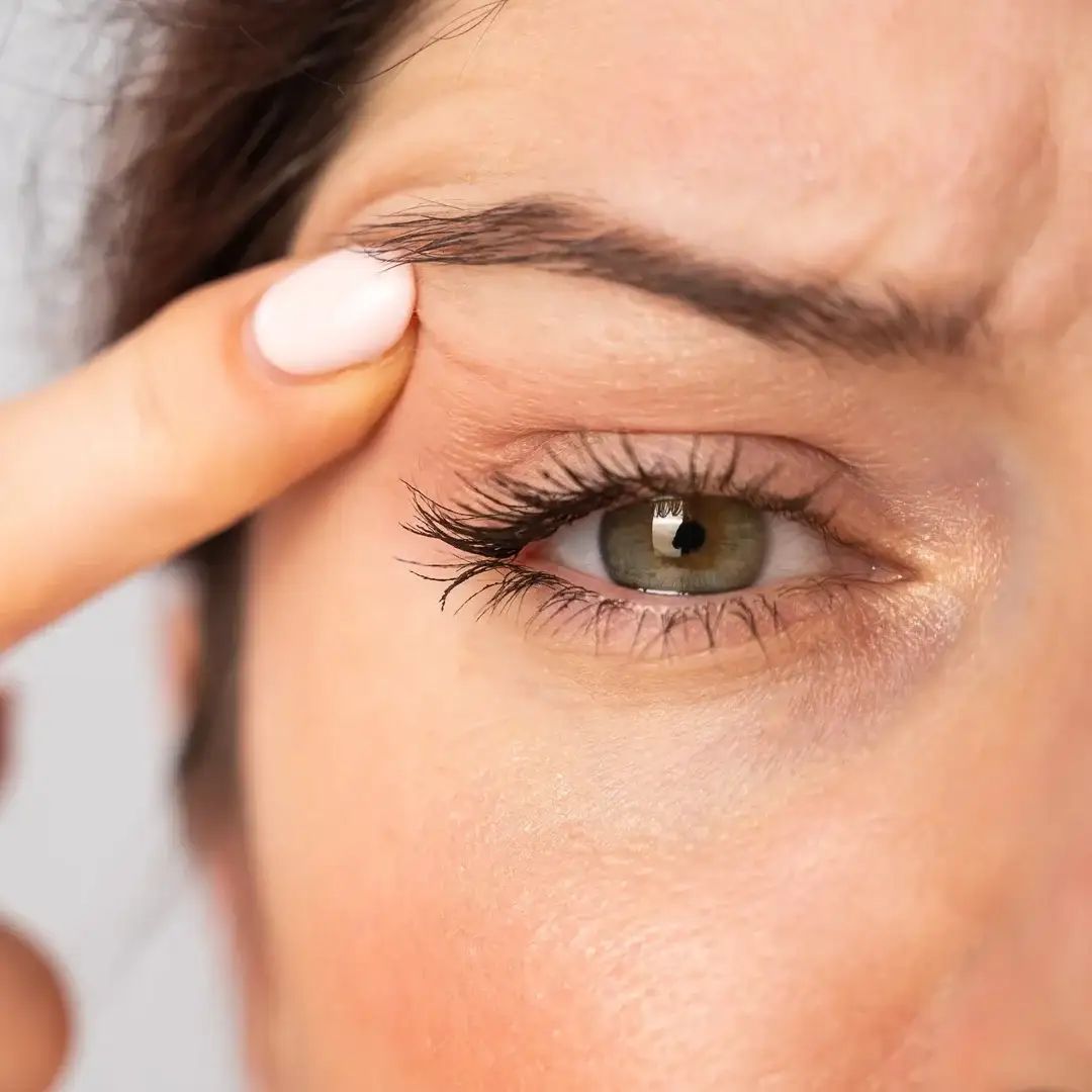 what-is-eyebrow-lift-turkey