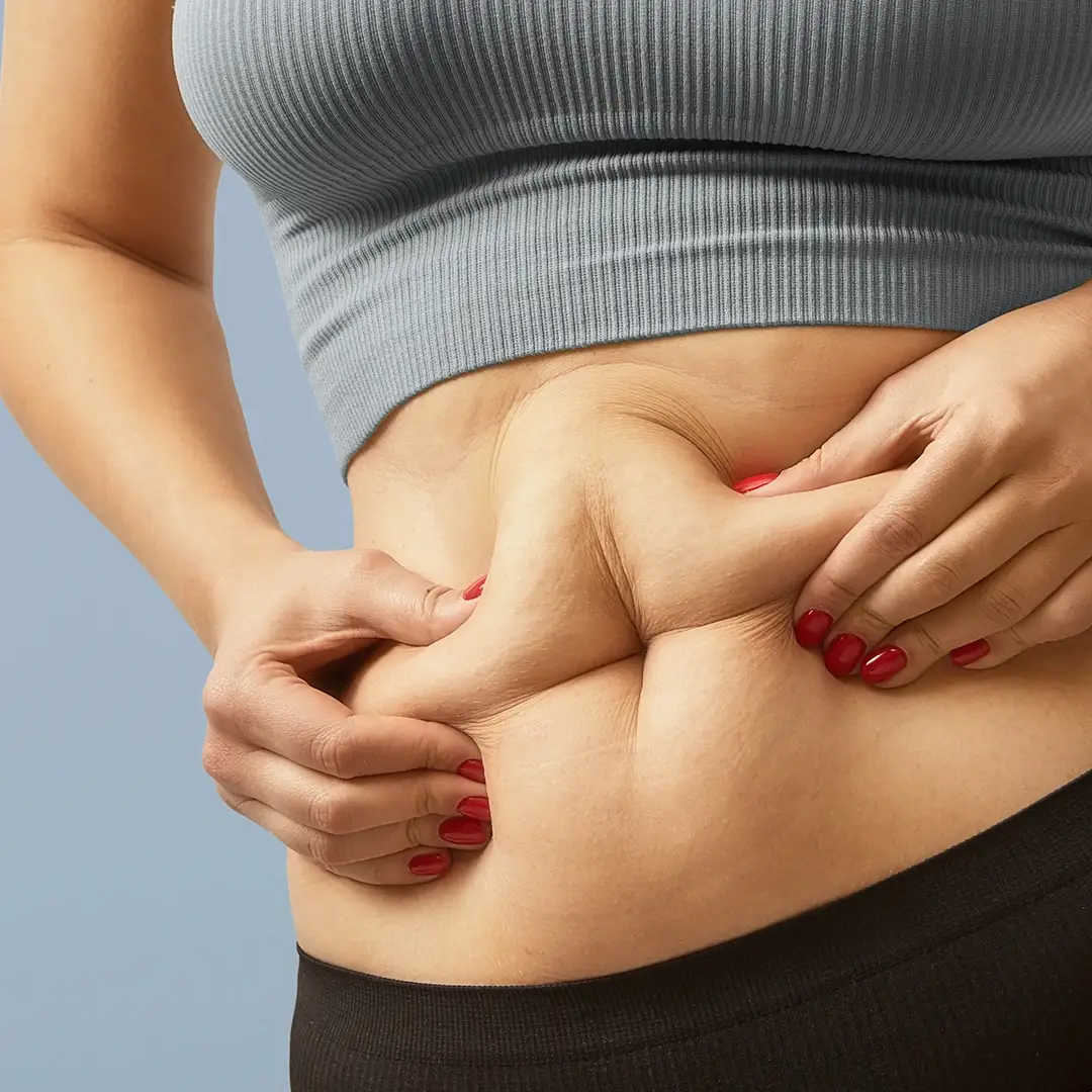 Cambiamenti positivi dopo bypass gastrico