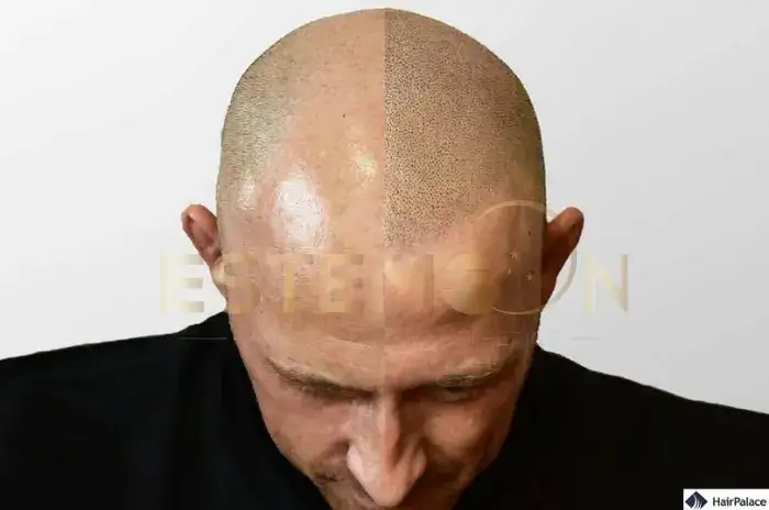 Hair Tottoo