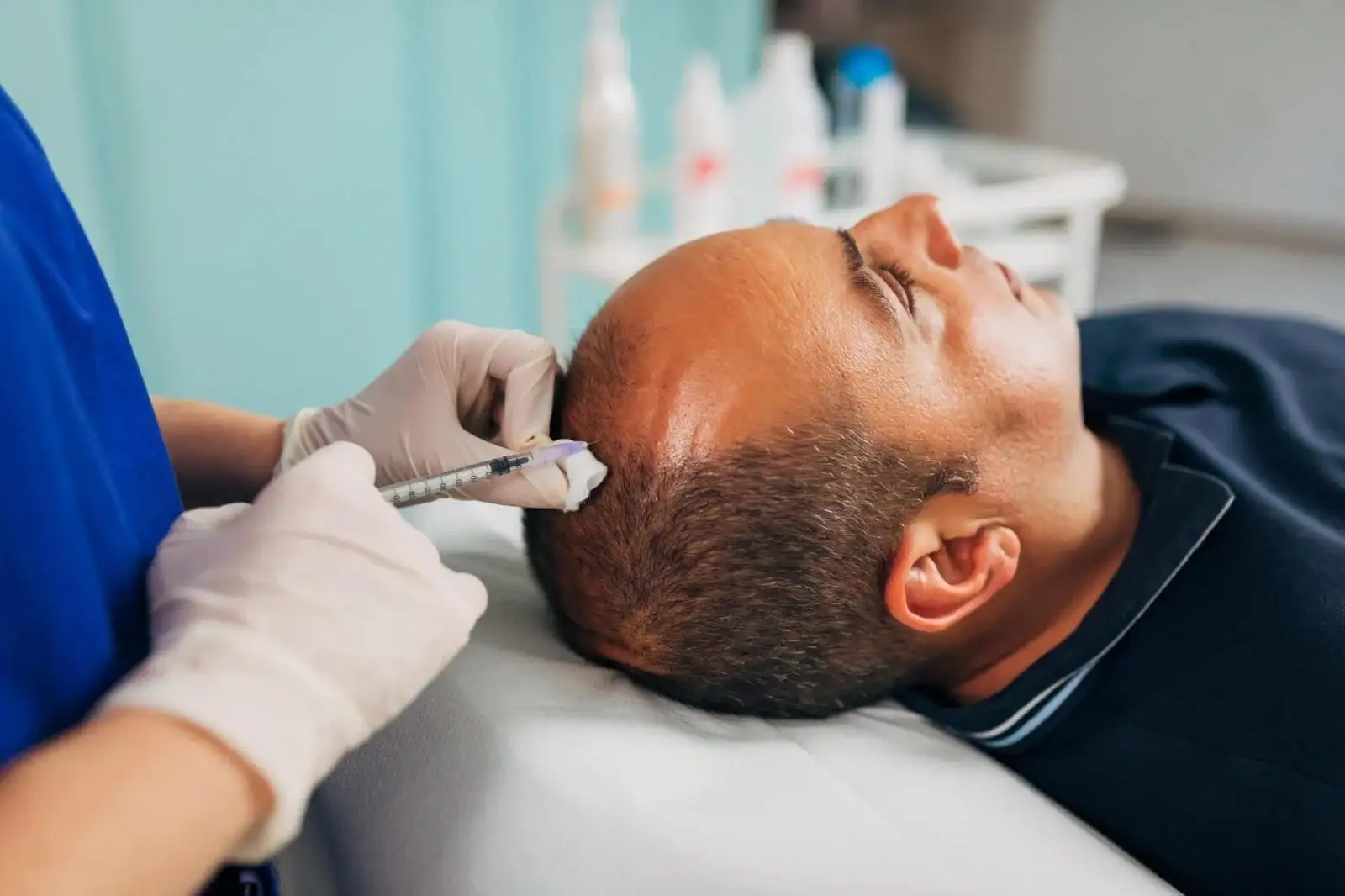 Hair Transplant Methods