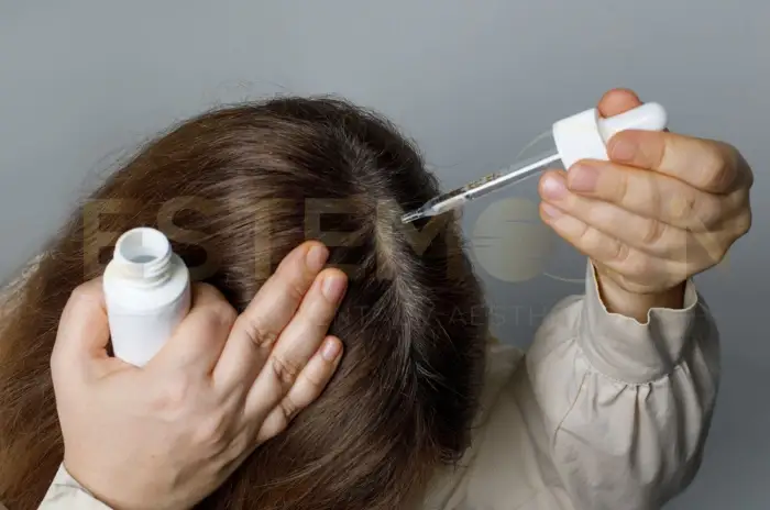 Finasteride for Women Hair Loss Benefits and Effects