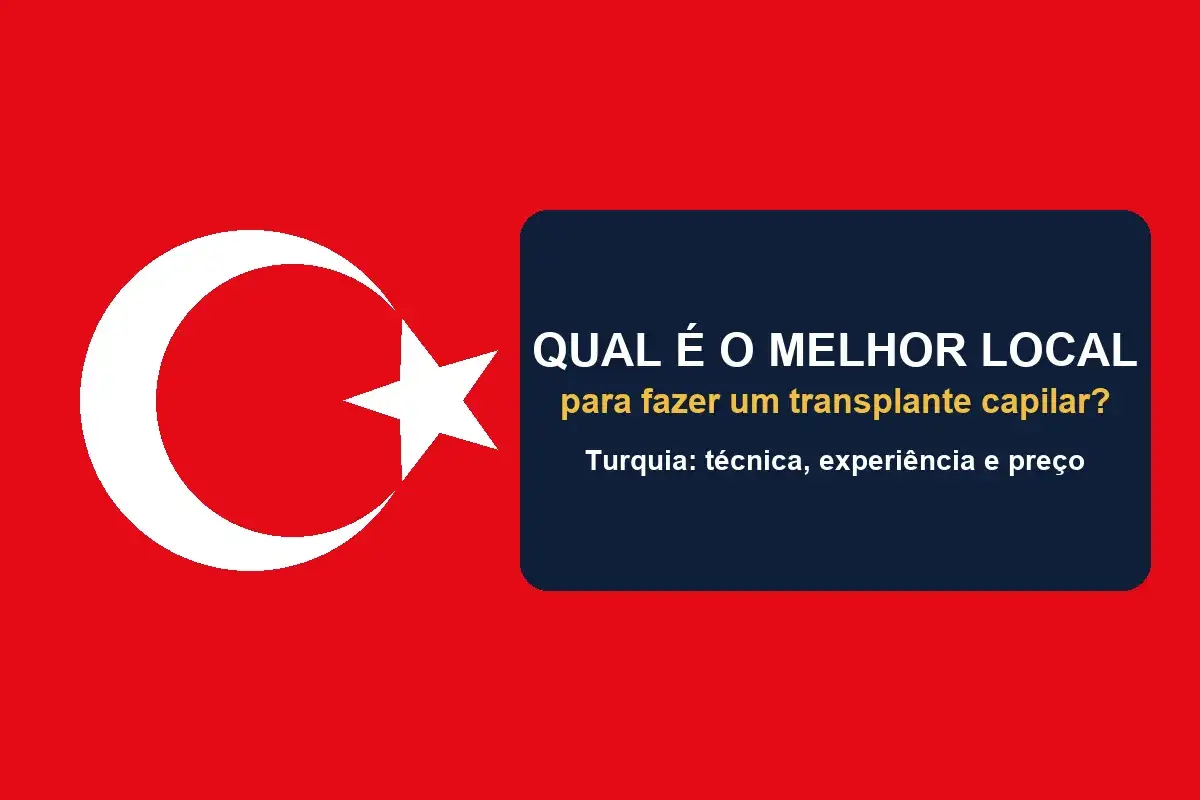 Bandeira da Turquia com o título: qual é o melhor local para fazer um transplante capilar