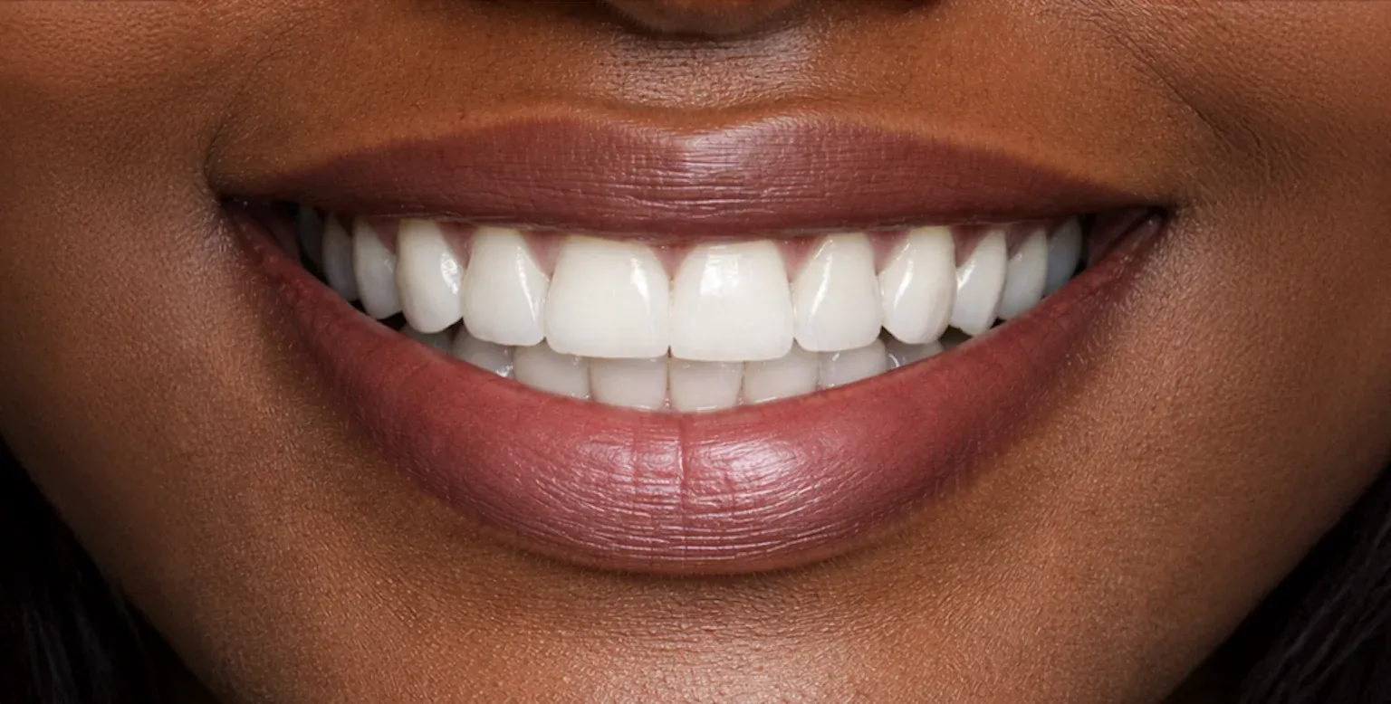 Dental Implant before-after10