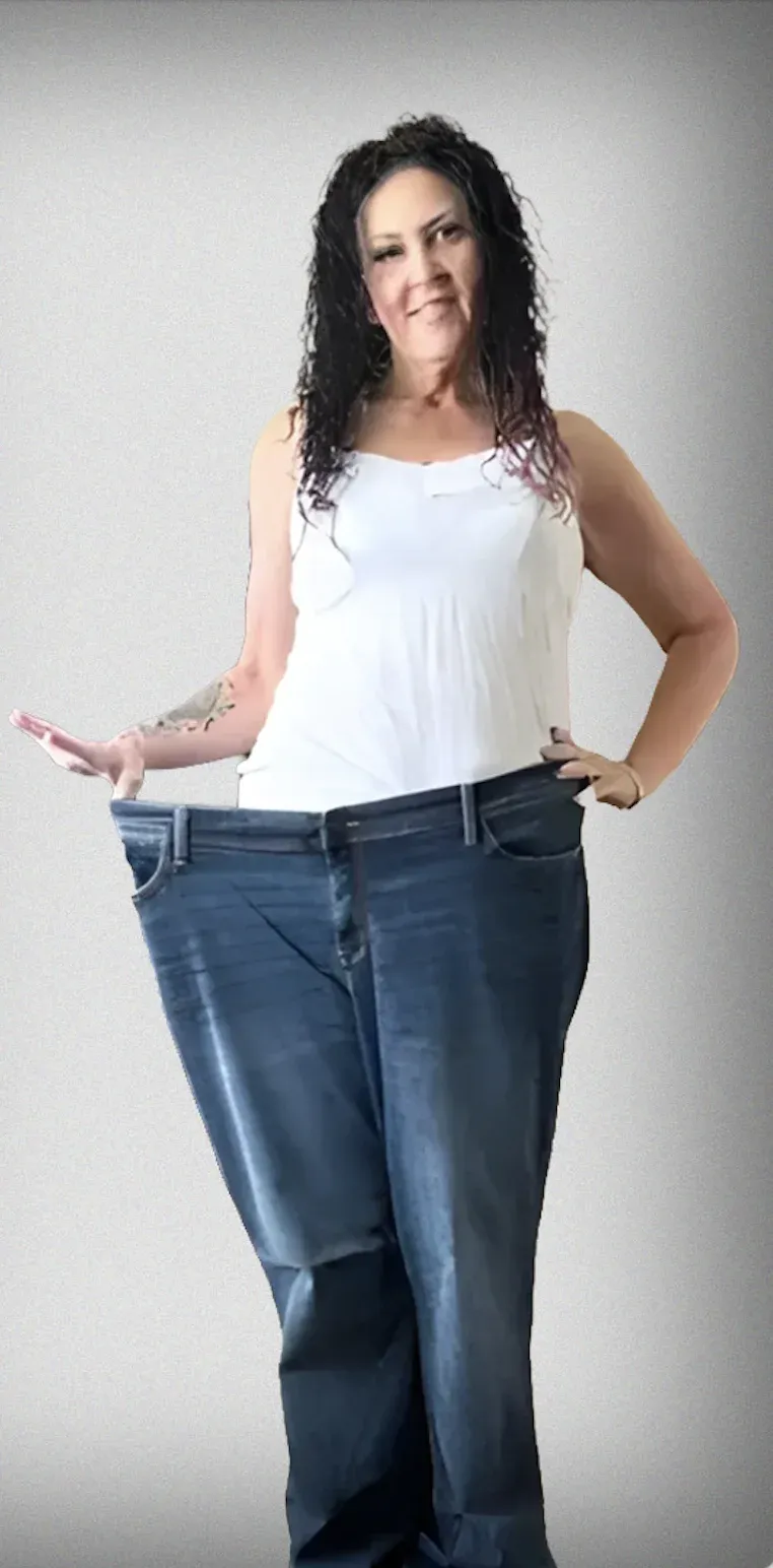 Gastric Bypass2