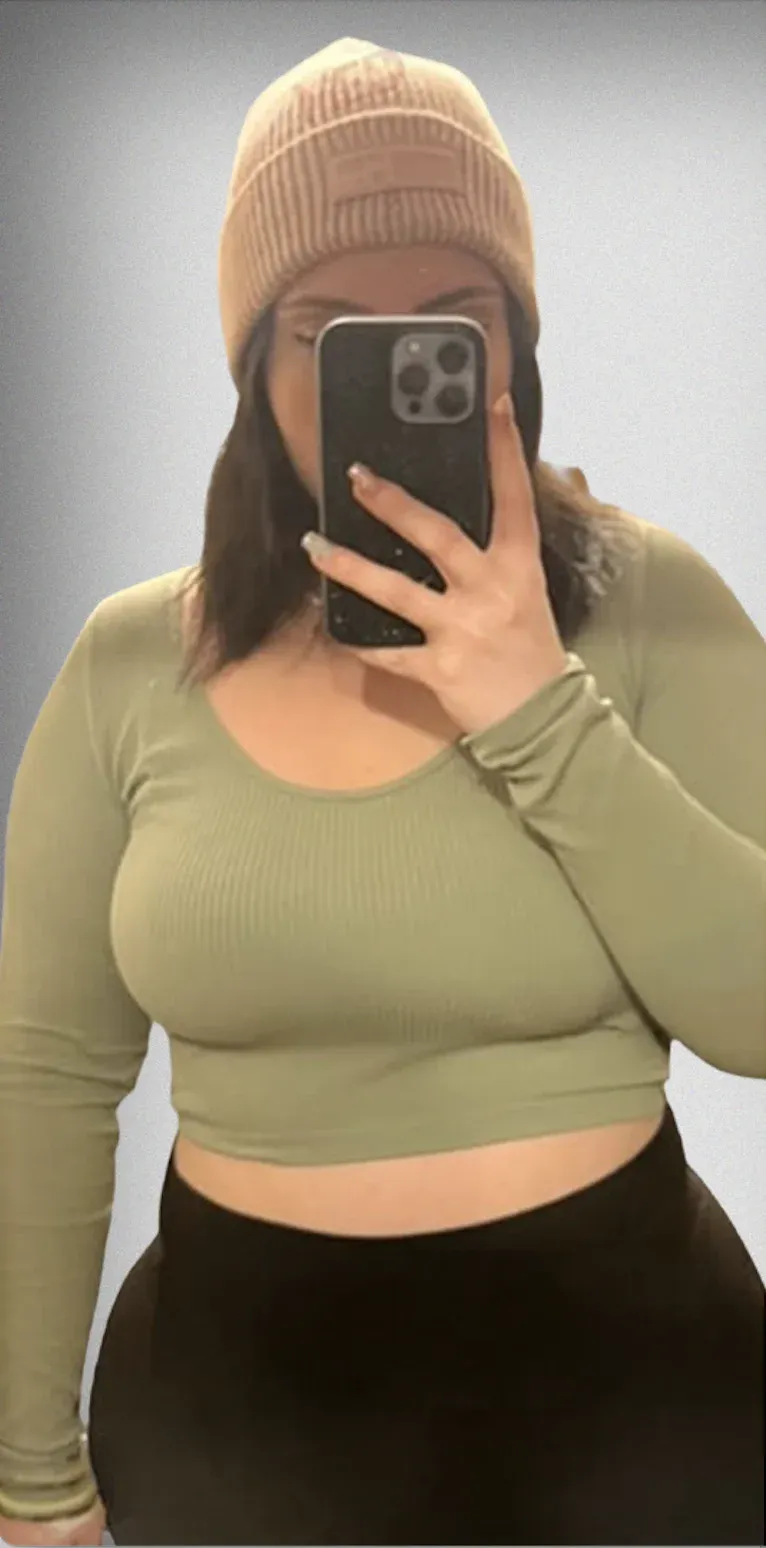 Gastric Bypass9