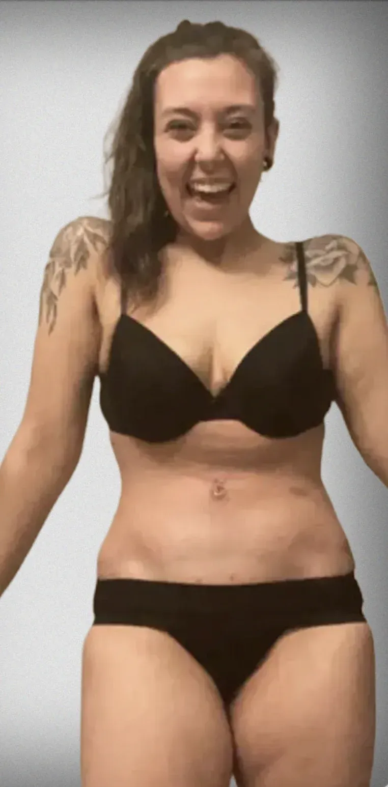 Tummy Tuck6