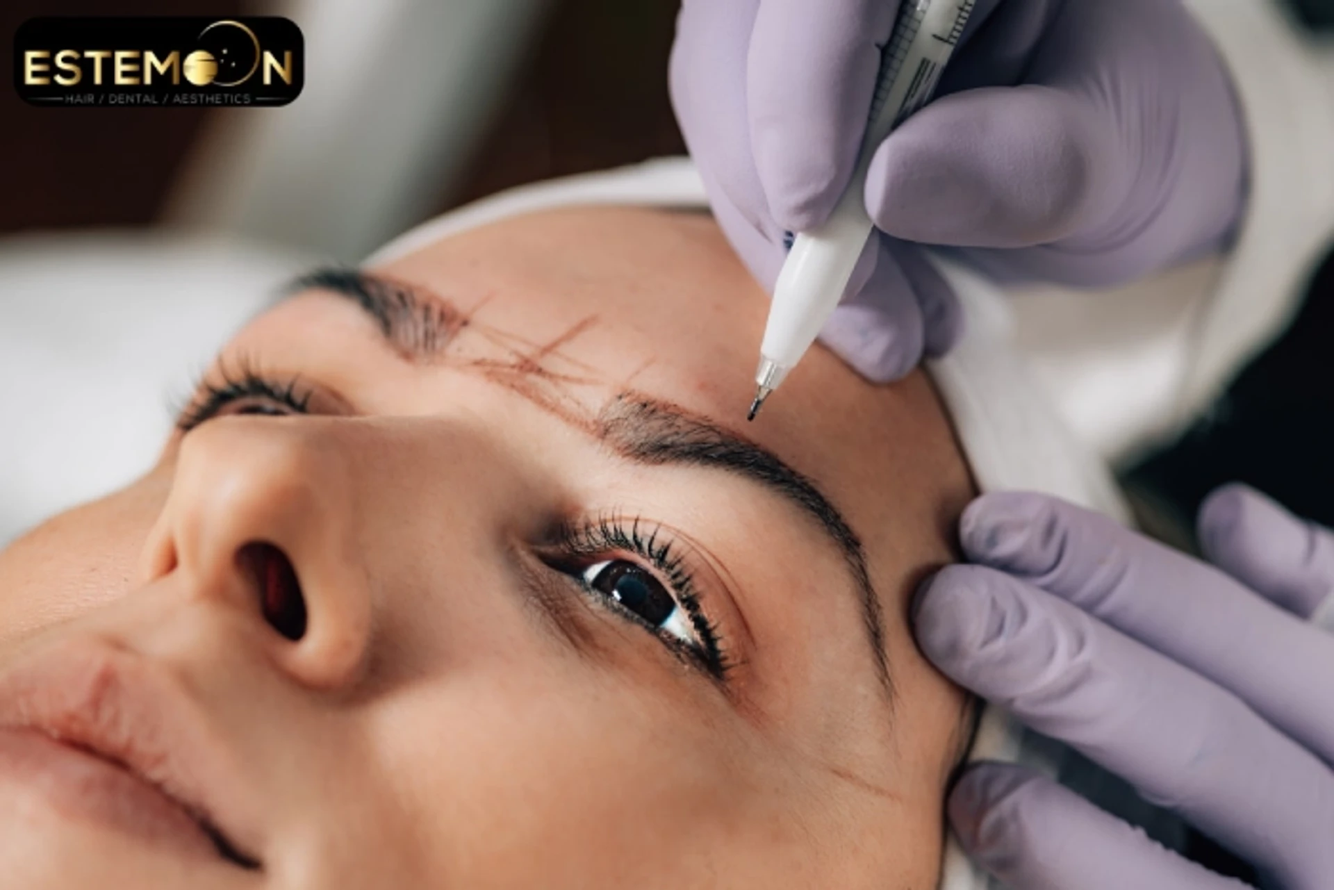 Trapianto di capelli per sopracciglia in Turchia Clinica Estemoon