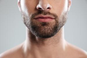 Beard Transplant