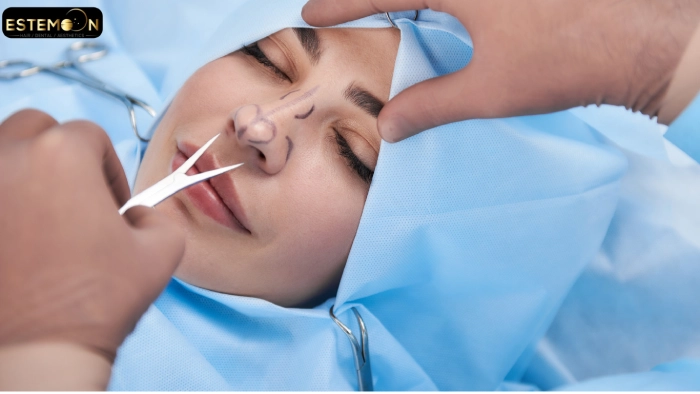 rhinoplasty in istanbul turkey