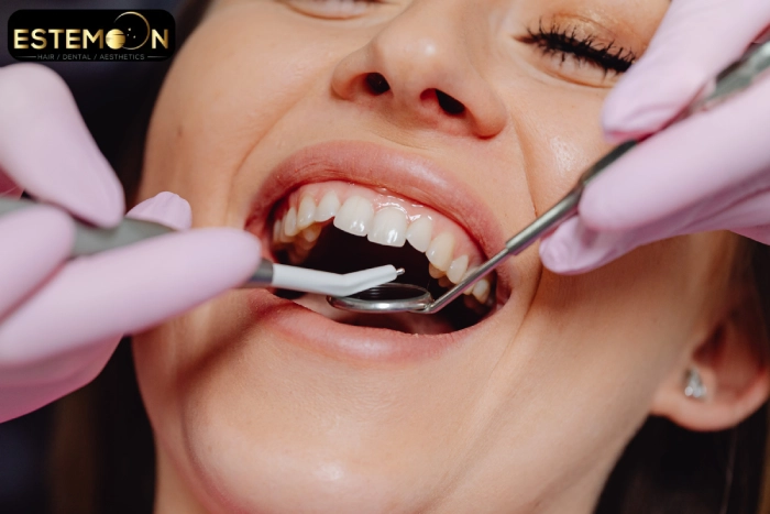 type of Procedures 
hollywood smile in istanbul