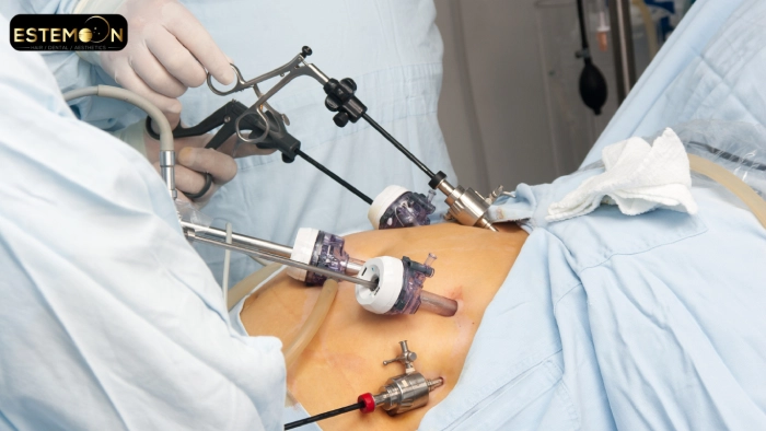 weight loss treatment in turkey