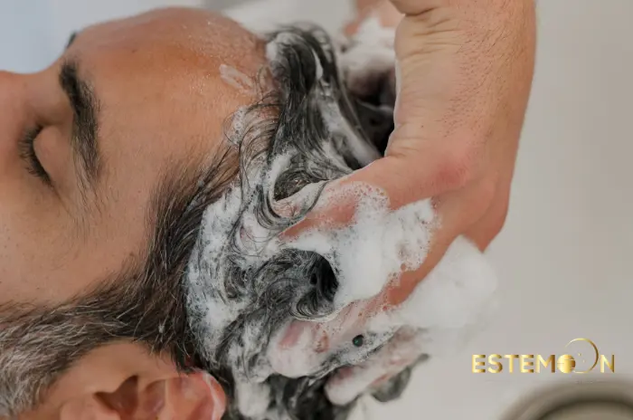 hair loss