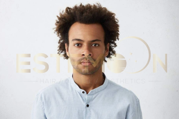 Afro hair transplant