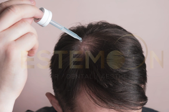 Effectiveness of finasteride in women