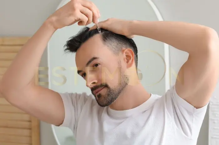 Exploring the Effectiveness of Topical Finasteride