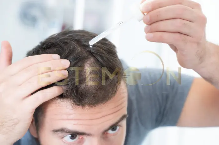 Finasteride Side Effects Explained, How to Use It