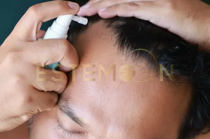 Finasteride Side Effects Explained How to Use and Manage Risks