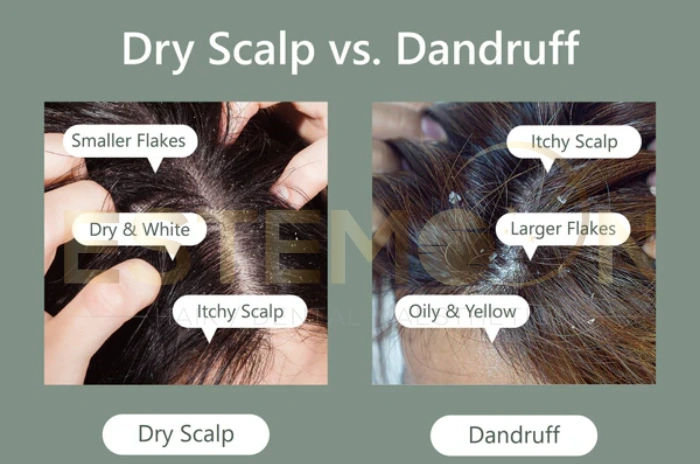 dry scalp