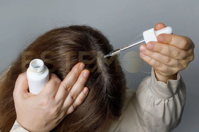 finasteride for women