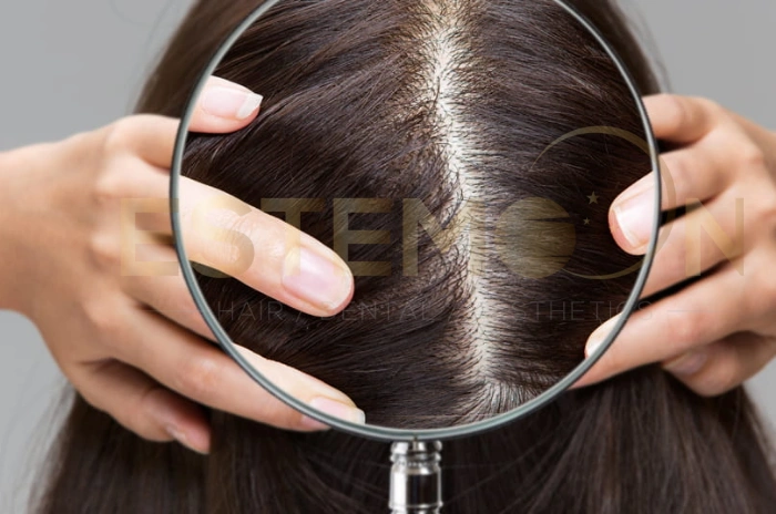 global hair growth market forecast