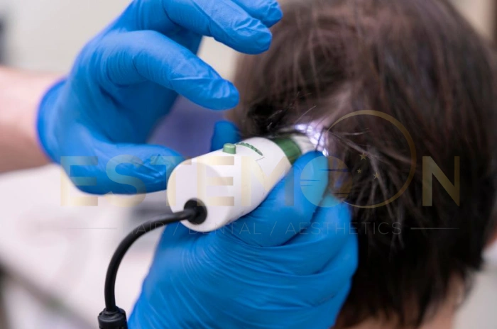 hair cloning technology