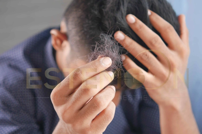 hair loss from smoking