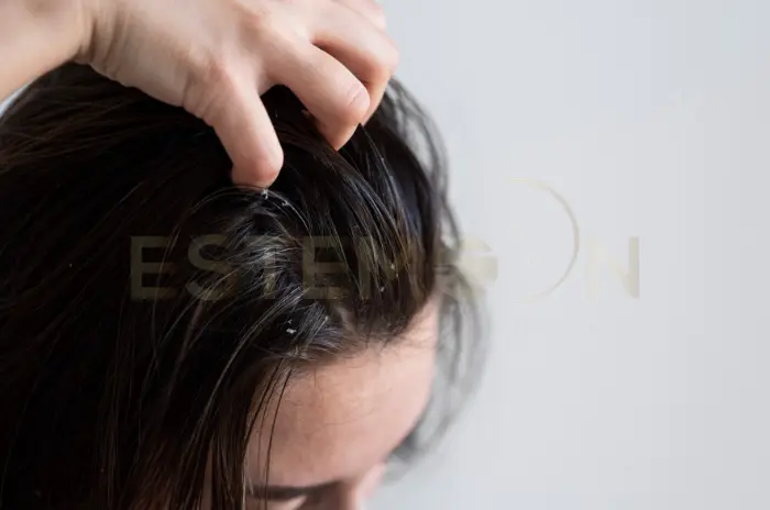 How to Fix Dry Scalp