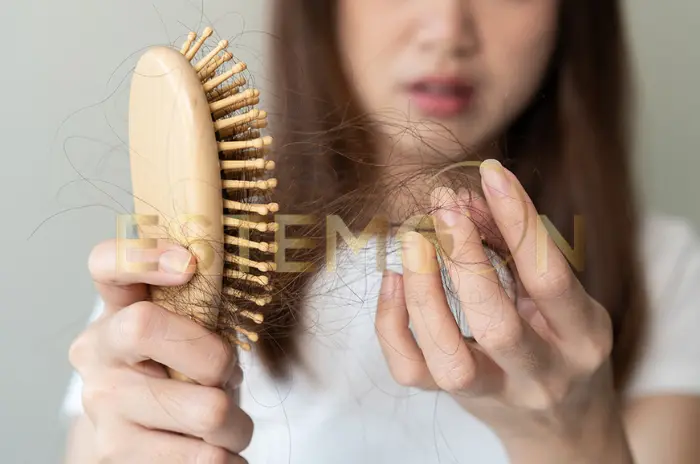 Postpartum Hair Loss Expert