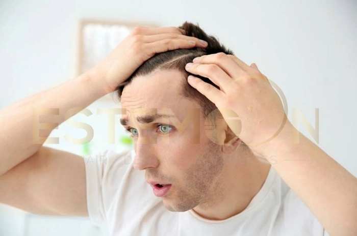 Thyroid symptoms hair loss