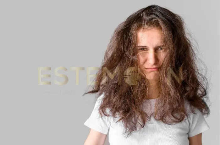 Treat PCOS Hair Loss with Natural Options (1)