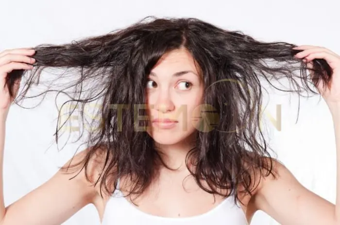Treat PCOS Hair Loss with Natural Options