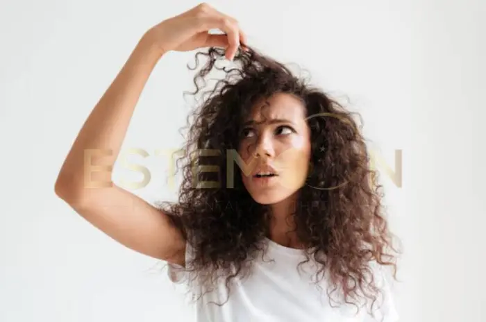 Treating PCOS Hair Loss with Natural Options